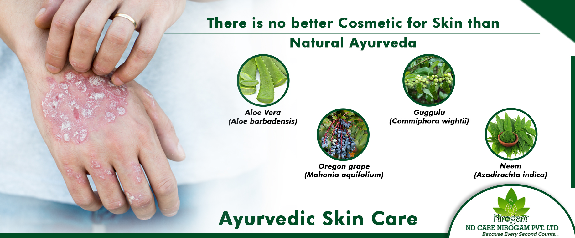 Ayurvedic Psoriasis Treatment ayurvedic-psoriasis-treatment